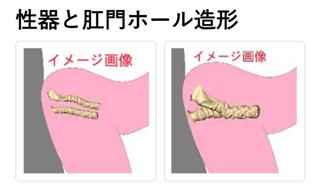 アナルが洗いやすい構造